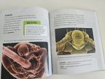 What You Need to Know About Head Lice - imagine 3