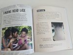 What You Need to Know About Head Lice - imagine 4
